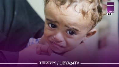 سوء التغذية