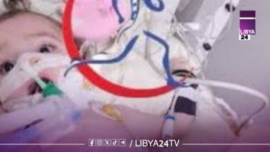 مرضى ضمور العضلات