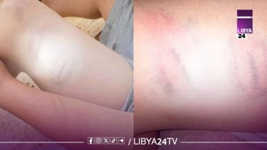 طفل معاق يتعرض للضرب المبرح فى مصراتة