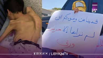 مرضى ضمور العضلات