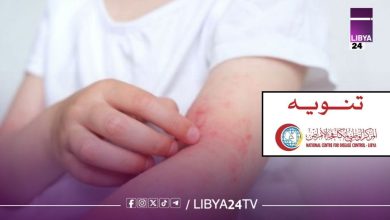 أعراض مرض الركيتسيا