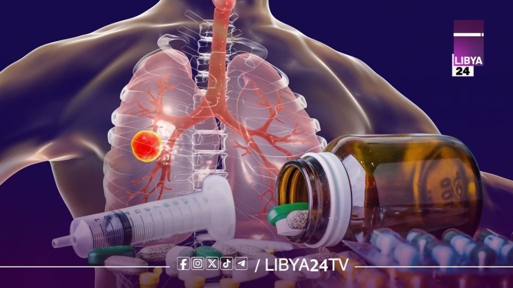 بعد تسجيل أكثر من 3 آلاف حالة في ليبيا… تحذيرات من وقف علاج الدرن