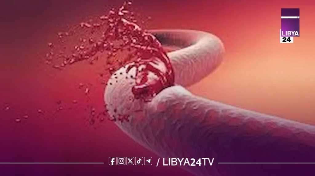 الناعور.. النزيف الصامت: كيف يحاصر المرضى الليبيين بين جينات ورثوها ونظام صحي منهك